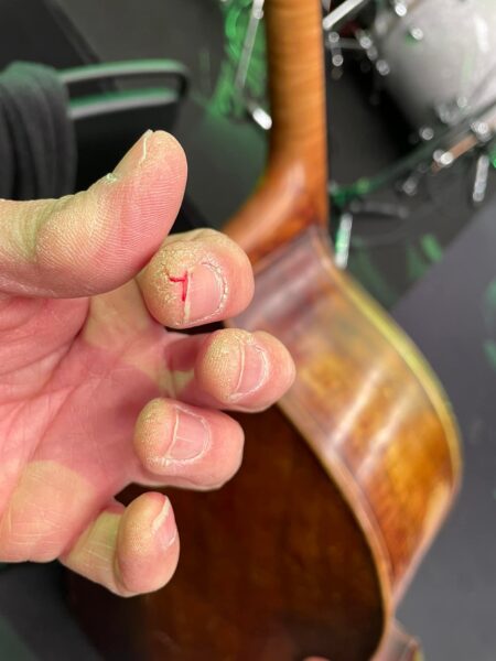 ついに指が悲鳴をあげました。